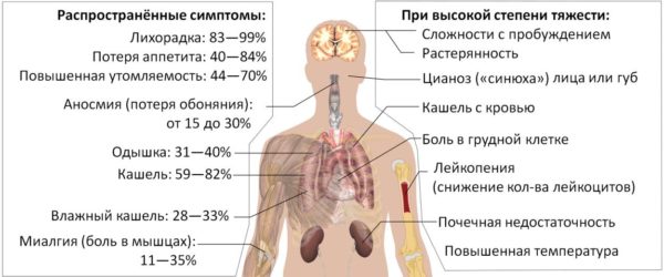 Симптомы заболевания ковид 19 у взрослых