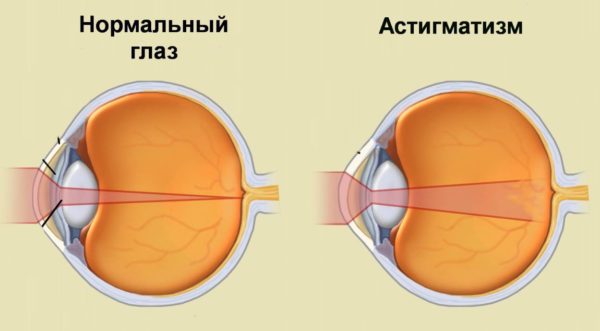 Лечение патологии